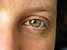 Jill's eye sure is purdy!